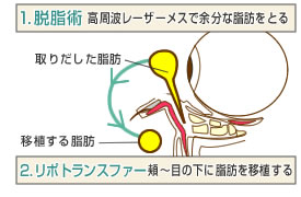 膨らんだ脂肪の影で「くま」に見える！