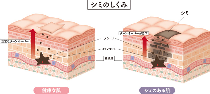 1．化粧品・医薬部外品（美白※化粧品）・医薬品！出来てしまったシミに効くのは？