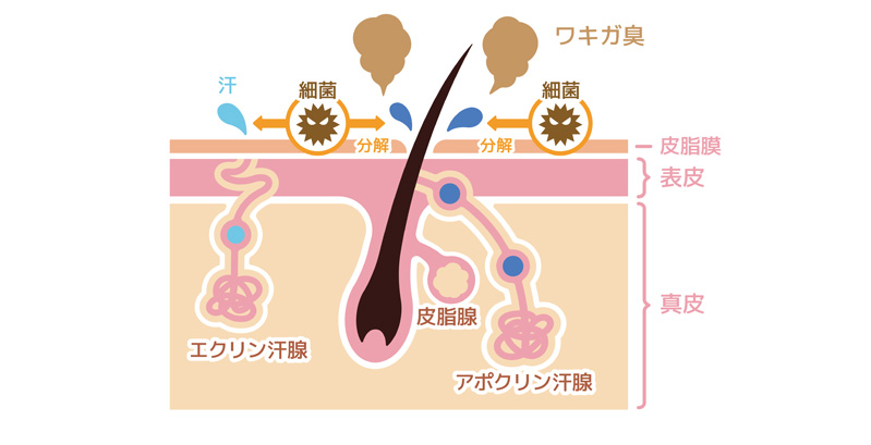 ワキガの原因は？