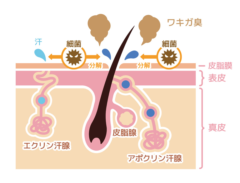 ワキガの原因は？