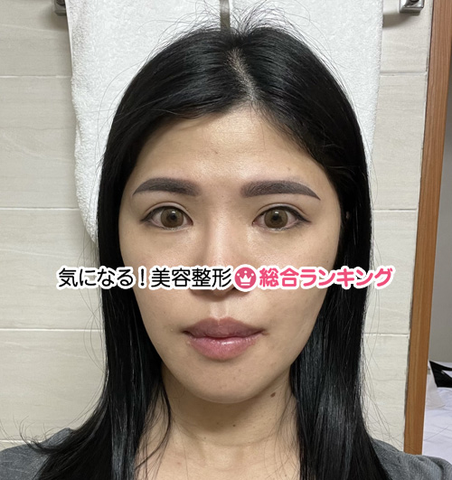 1回目：シャドー眉とアイライン after