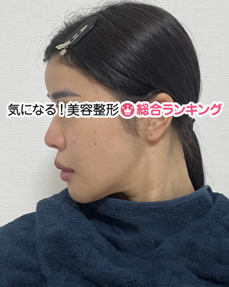 2024年11月のななさん