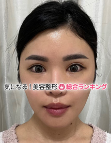 2018年のななさん（当時21歳）
