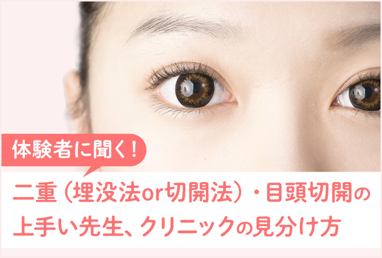 【体験者に聞く！】二重（埋没法or切開法）・目頭切開の上手い先生、クリニックの見分け方