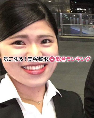 2018年頃のななさん（当時21歳）
