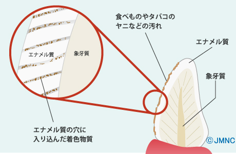 着色汚れ 着色汚れ
