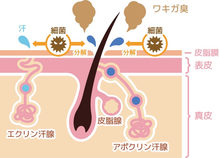 ワキガは「汗」そのものではなく「常在菌」が原因 ワキガは「汗」そのものではなく「常在菌」が原因