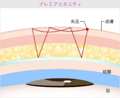 プレミアエタニティ