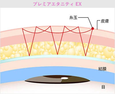 プレミアエタニティ　EX